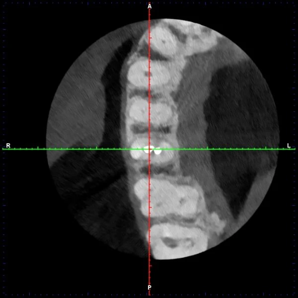 A scan of teeth