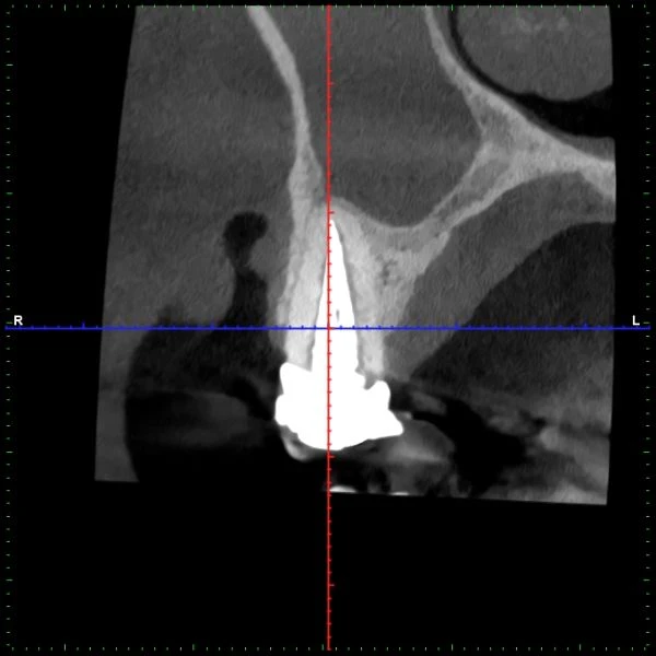 A scan of a tooth