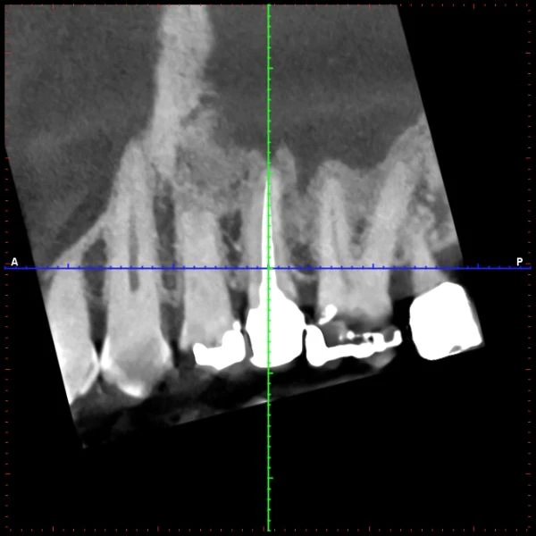 A scan of a row of teeth